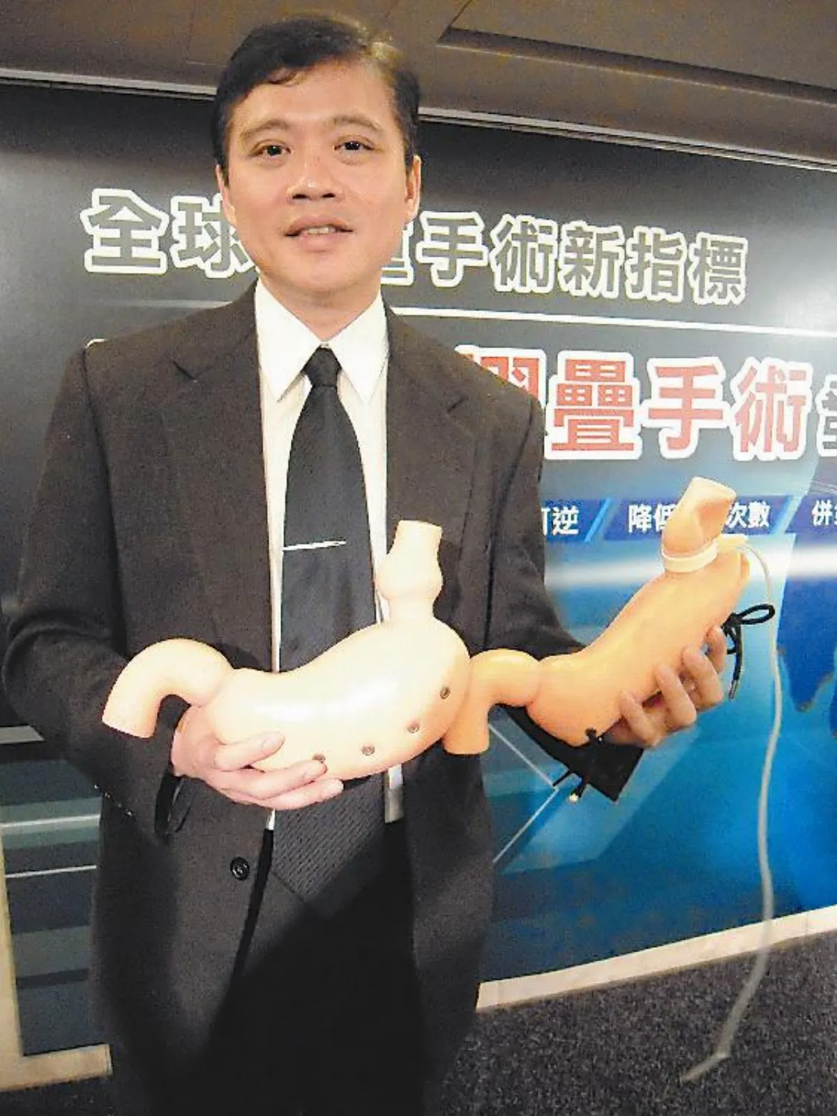 胃束帶摺疊 減重手術新法