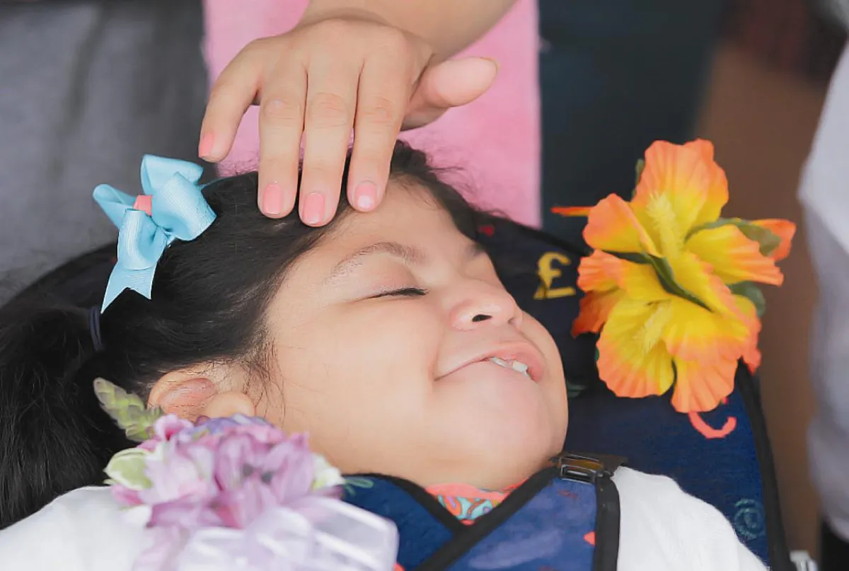 連體嬰10歲了