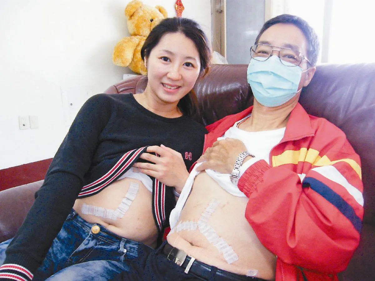 女兒捐肝 父女同肝共苦