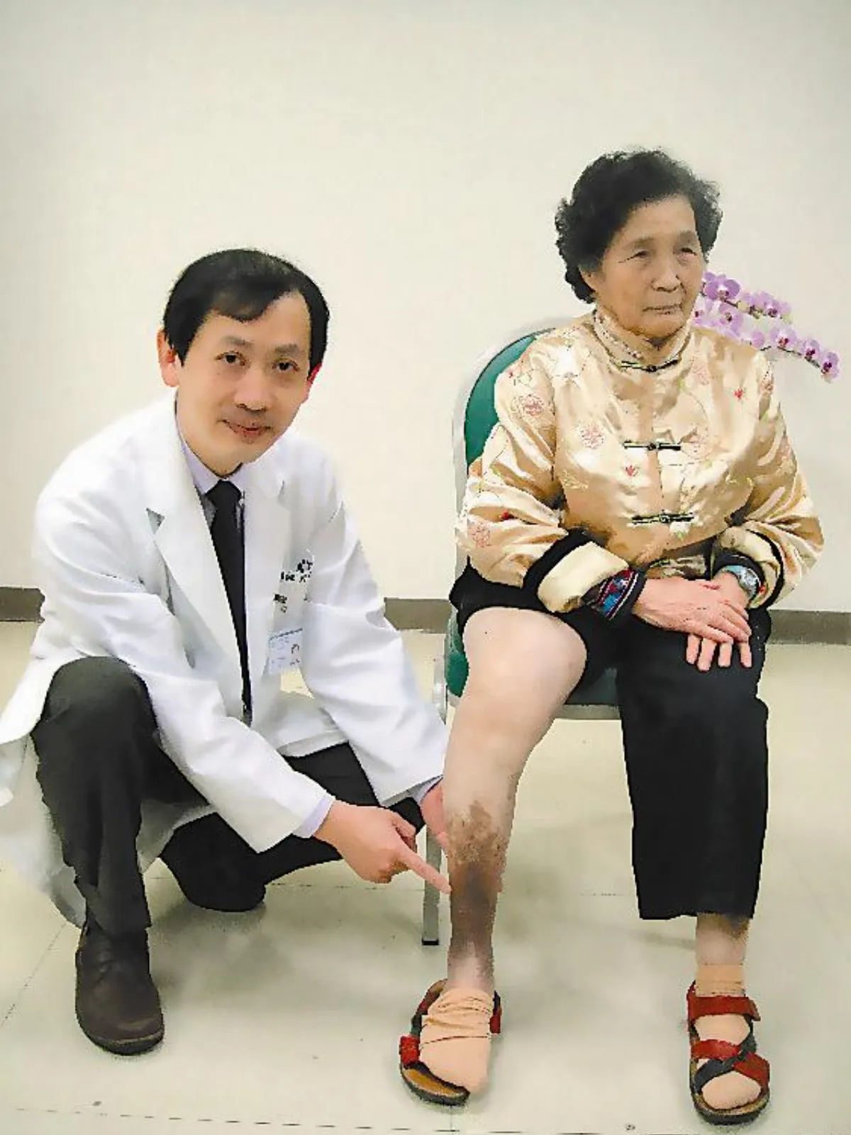 阿嬤腳潰爛 靜脈曲張惹禍