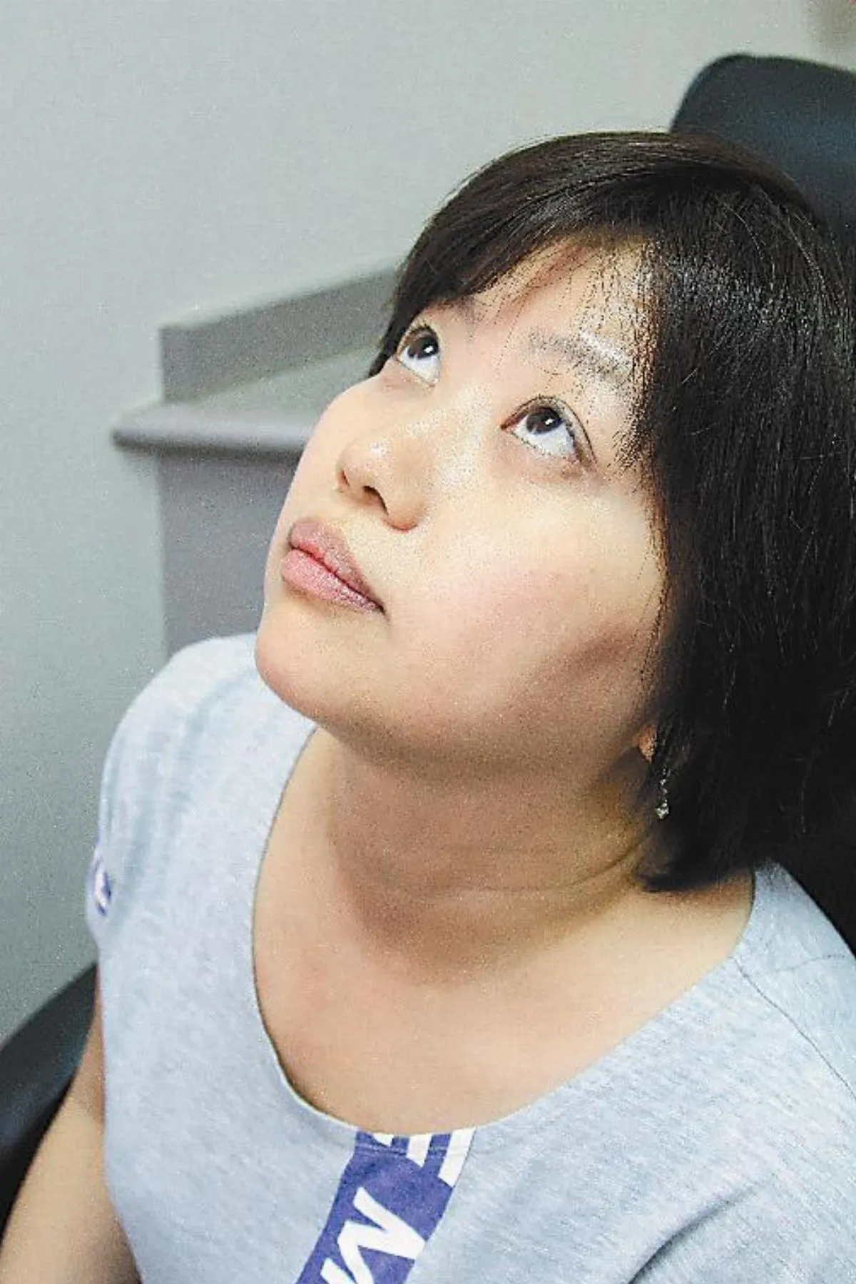 點眼藥水不當 易刮傷角膜