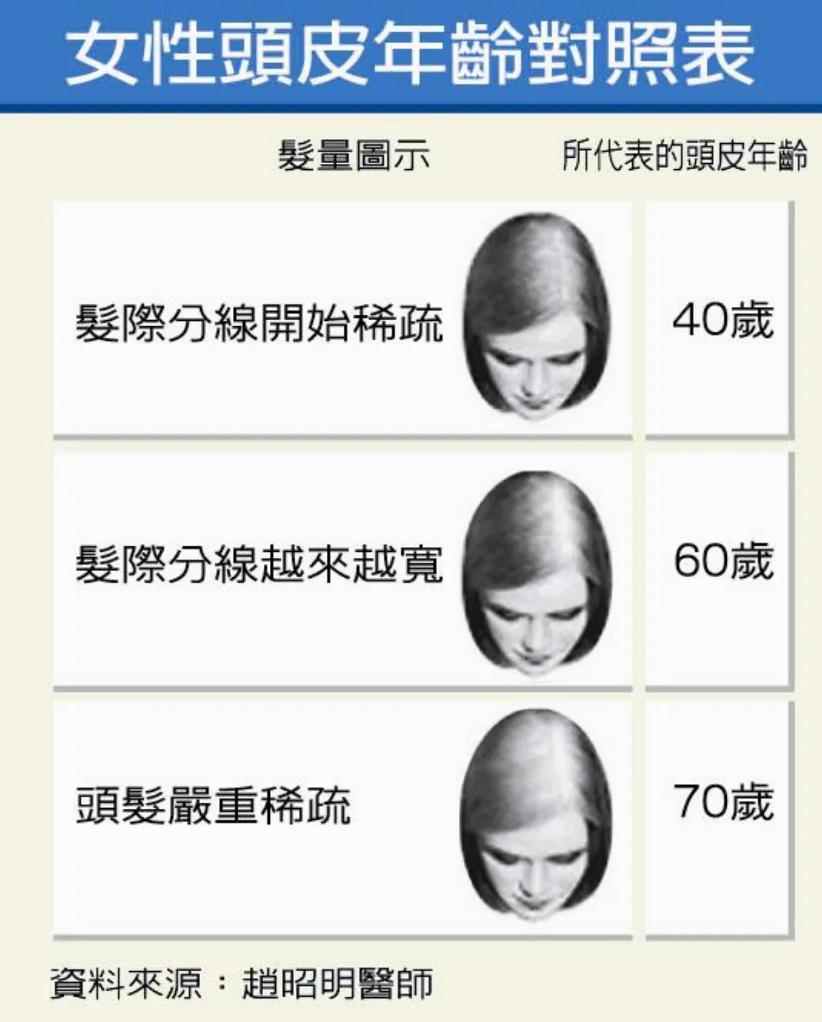 常染燙 妙齡女雄性禿