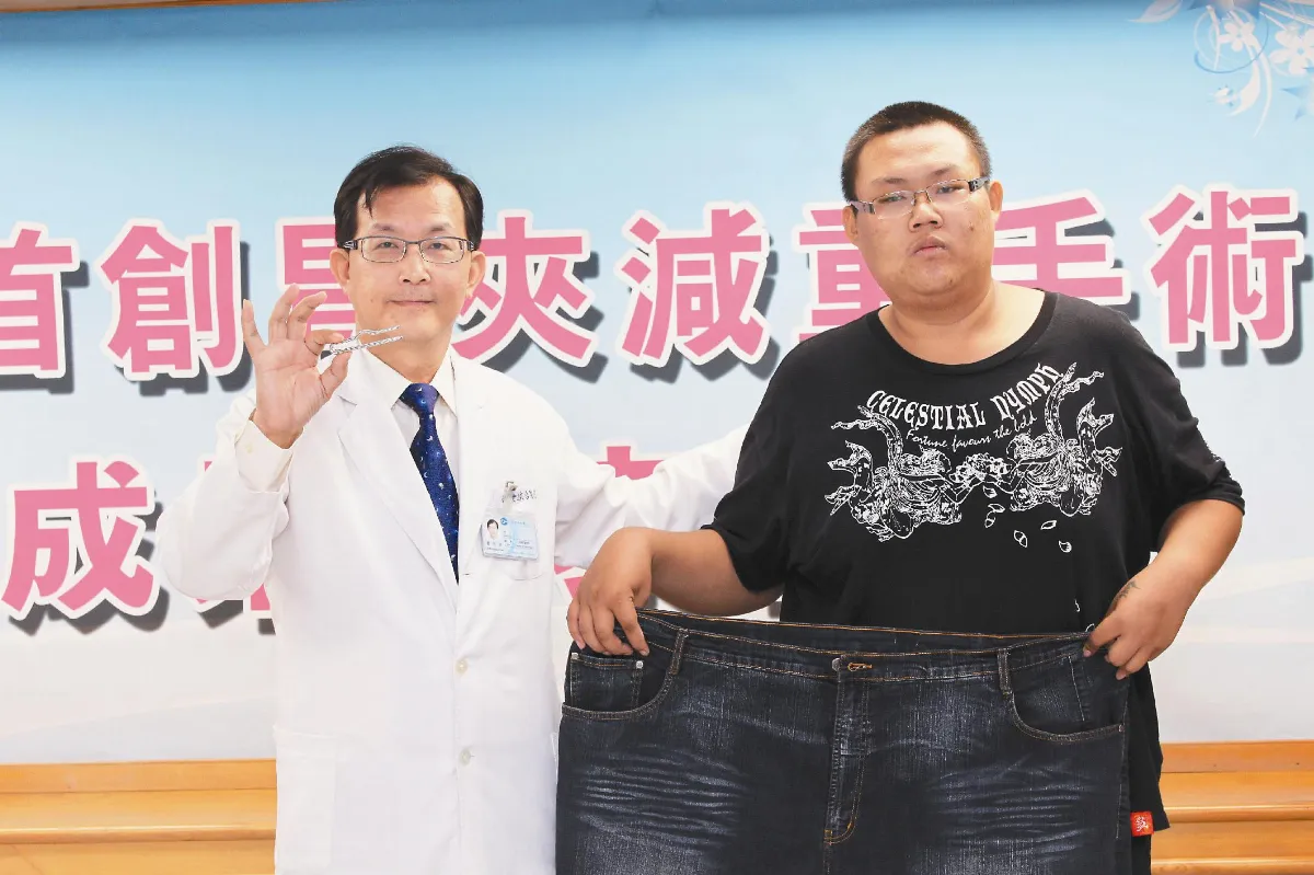 胃夾手術 減重新選擇