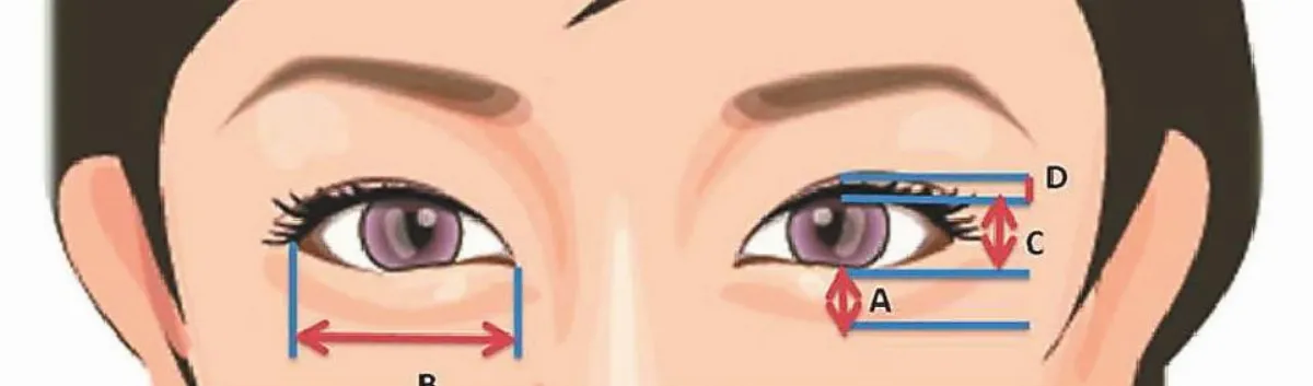 臥蠶非眼袋 造就迷人電眼