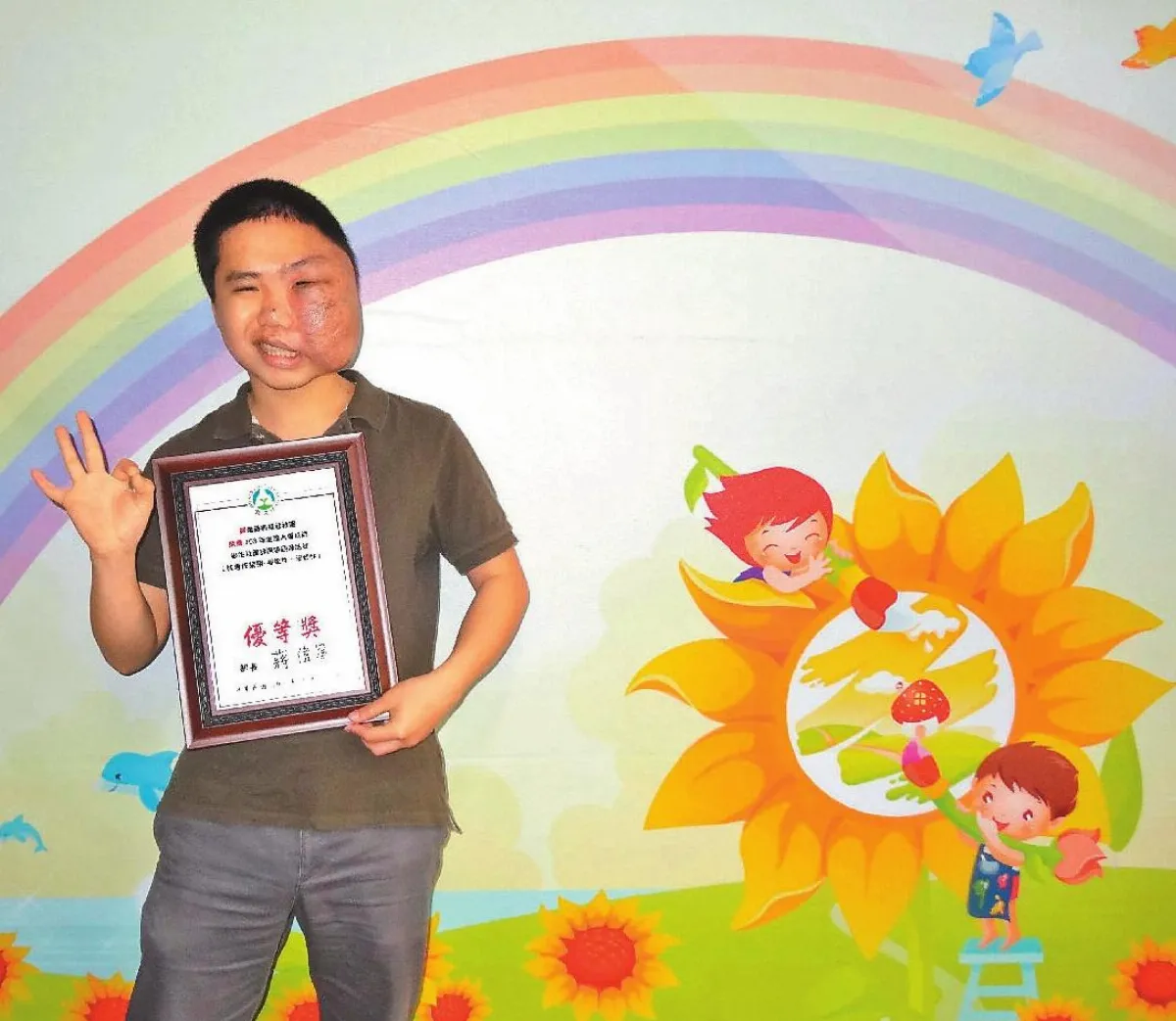 不因臉部腫瘤而自卑 陽光男孩 參與社團照亮他人