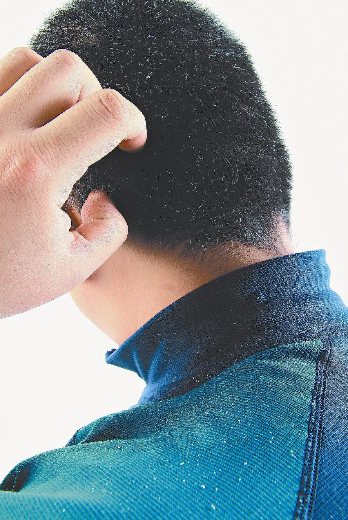 中醫觀點：談過敏3 為何皮膚過敏也這麼多？