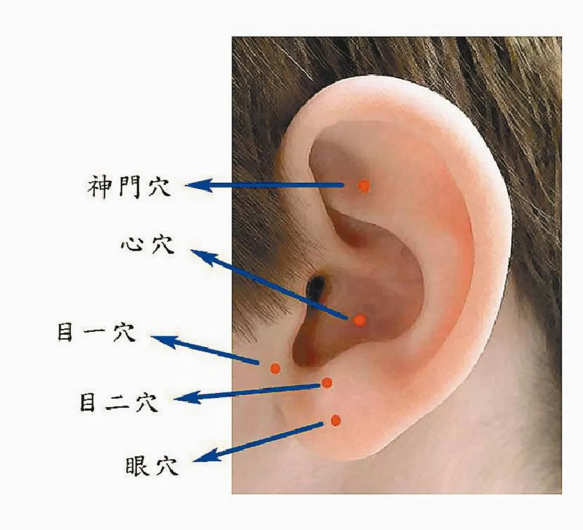 耳朵勤按摩 有效減緩兒童近視