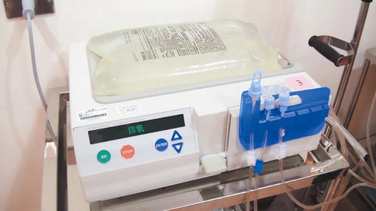 全自動腹膜透析 機器代勞少感染