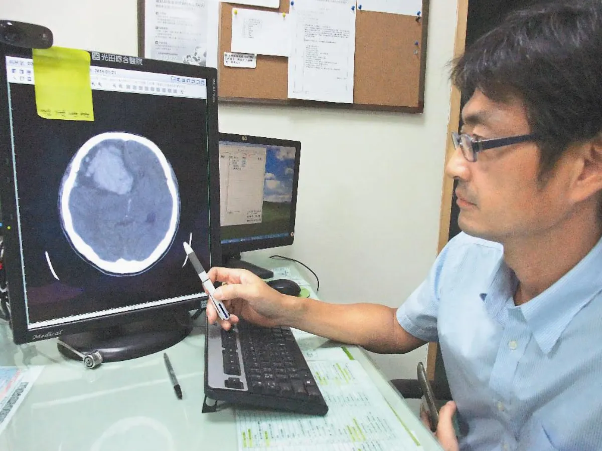 罕見腫瘤腦出血  存活首例