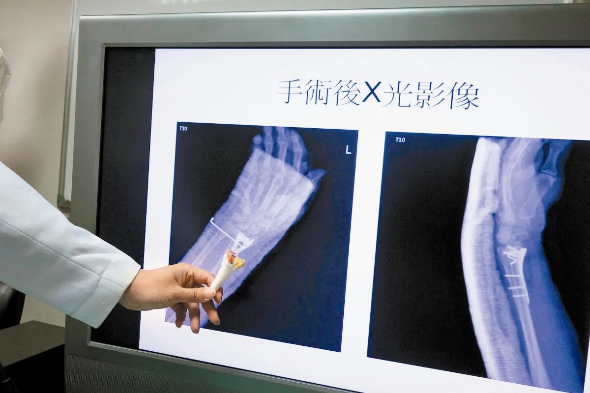 3Ｄ列印骨模型 開刀更加精確