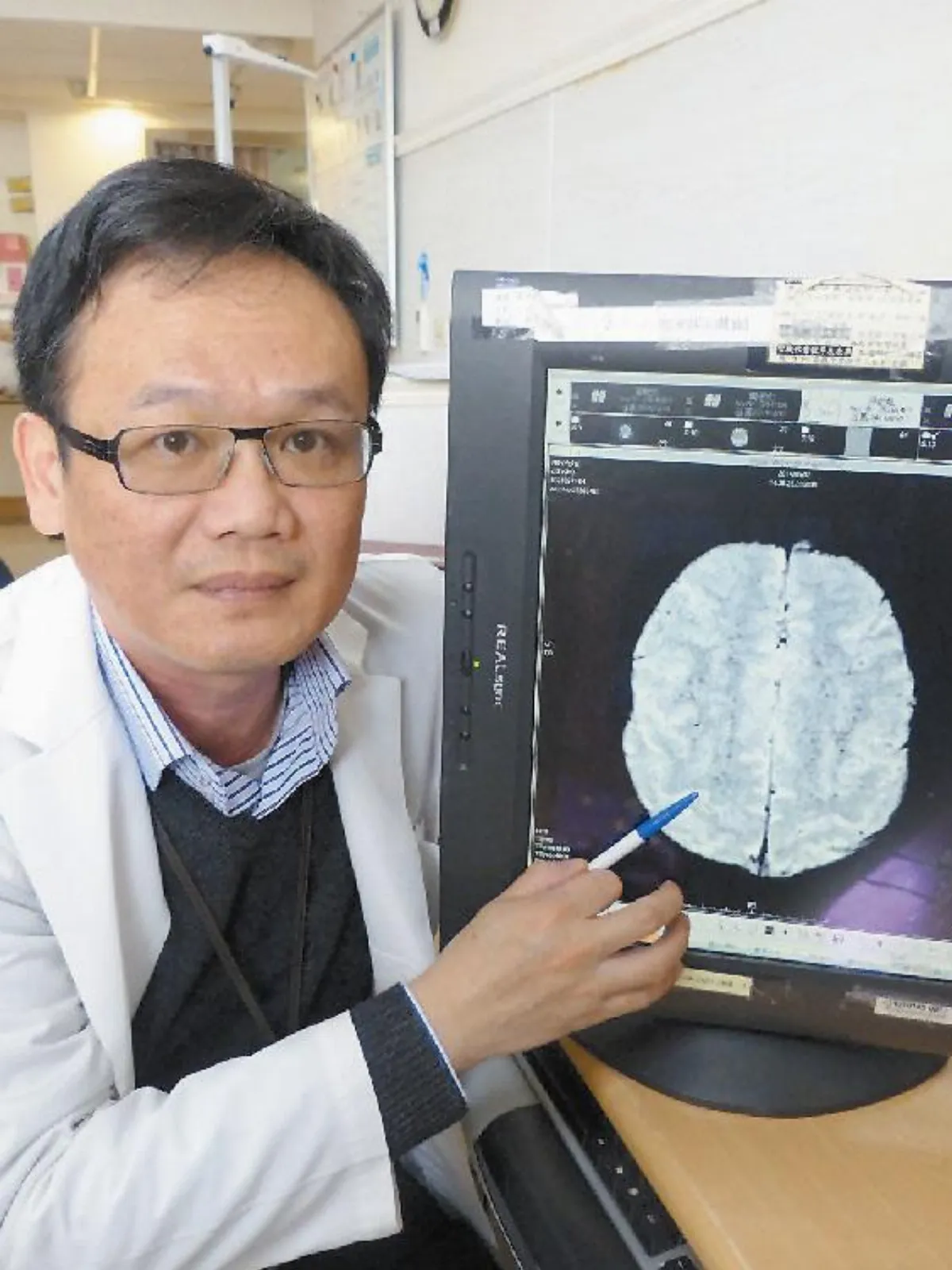 骨折併發腦脂肪栓塞 死亡率高