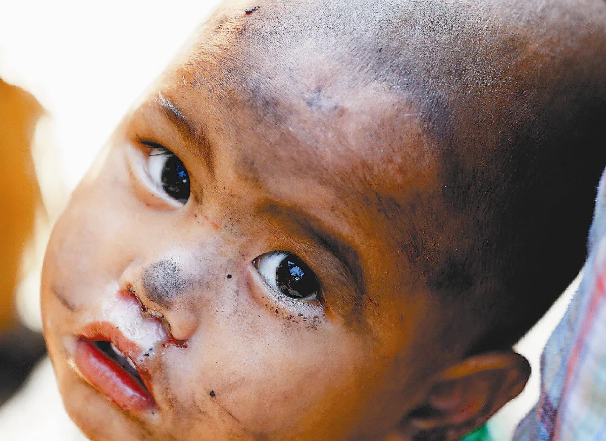 菲祝融毀5千屋 50萬人流離