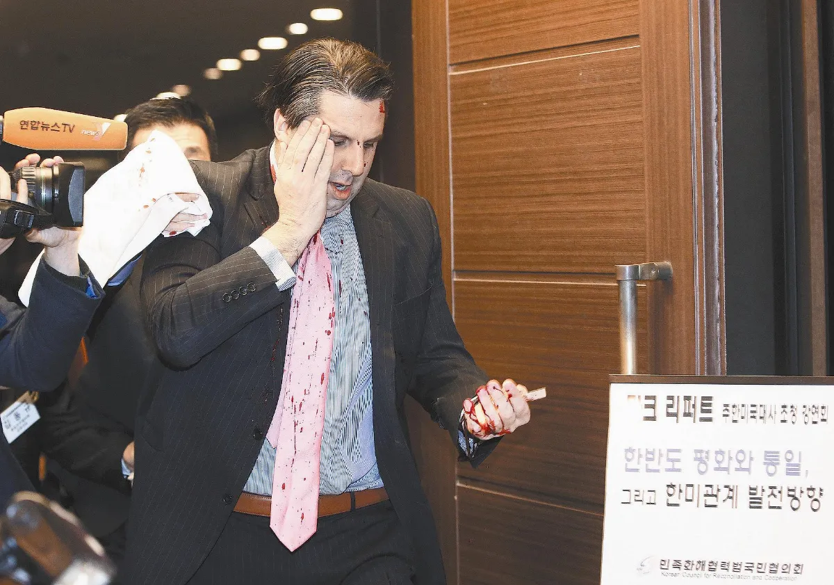 美駐韓大使遇襲 臉縫80針