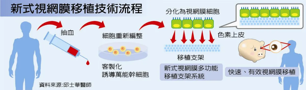 視網膜客製化 黃斑部病變有救
