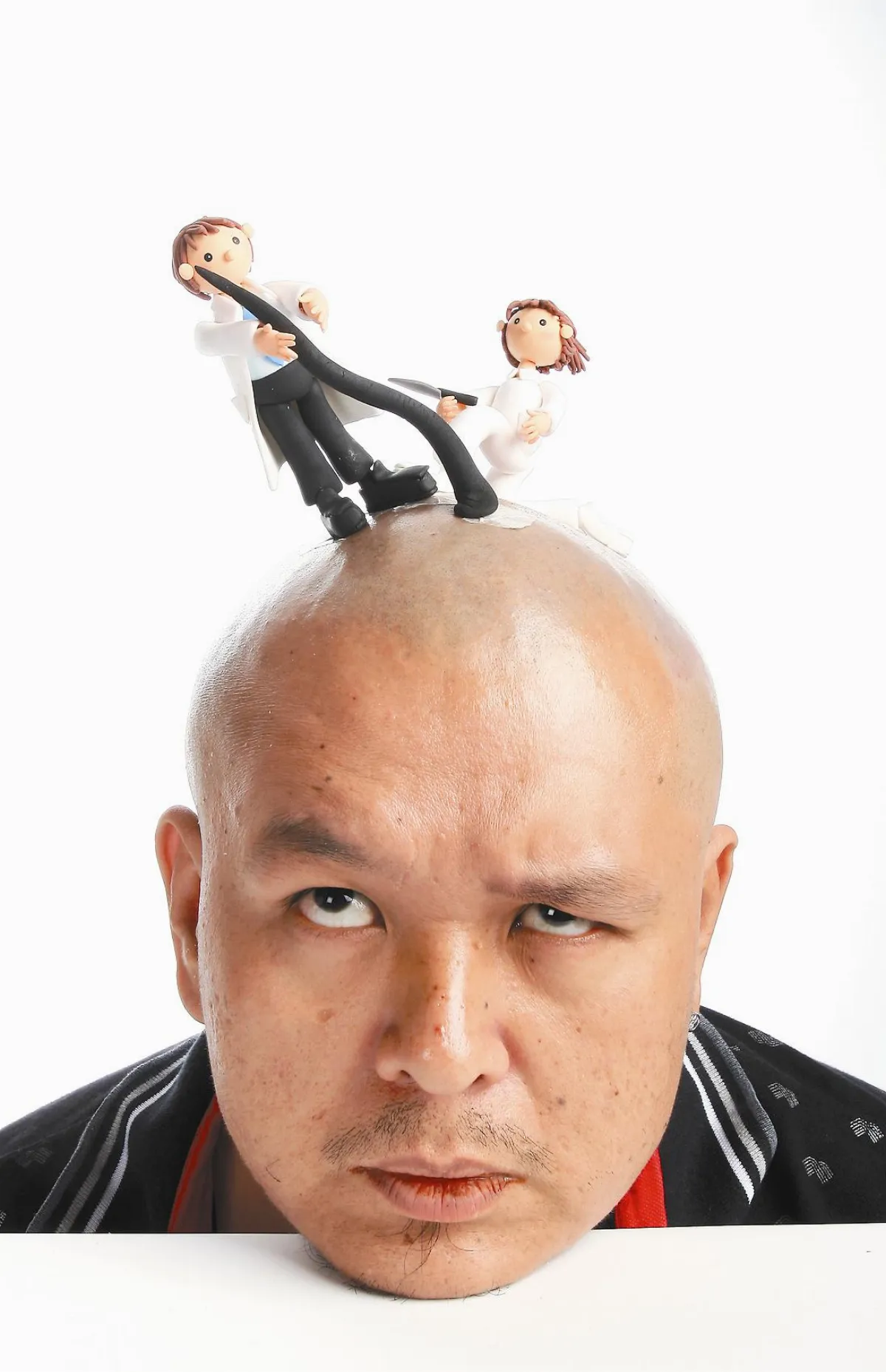頂上拔毛 刺激毛囊誘髮再生
