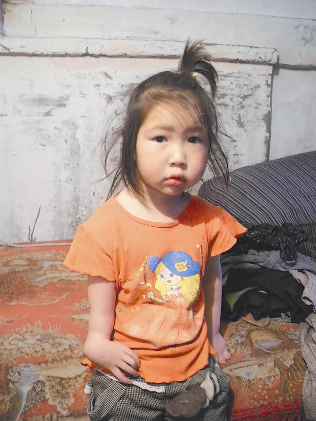 缺臂女童來台就醫 圓牽手夢