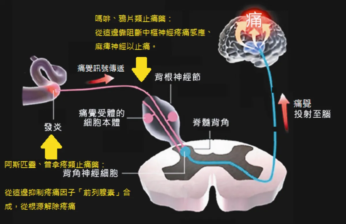 打嗎啡止痛 怎失效？