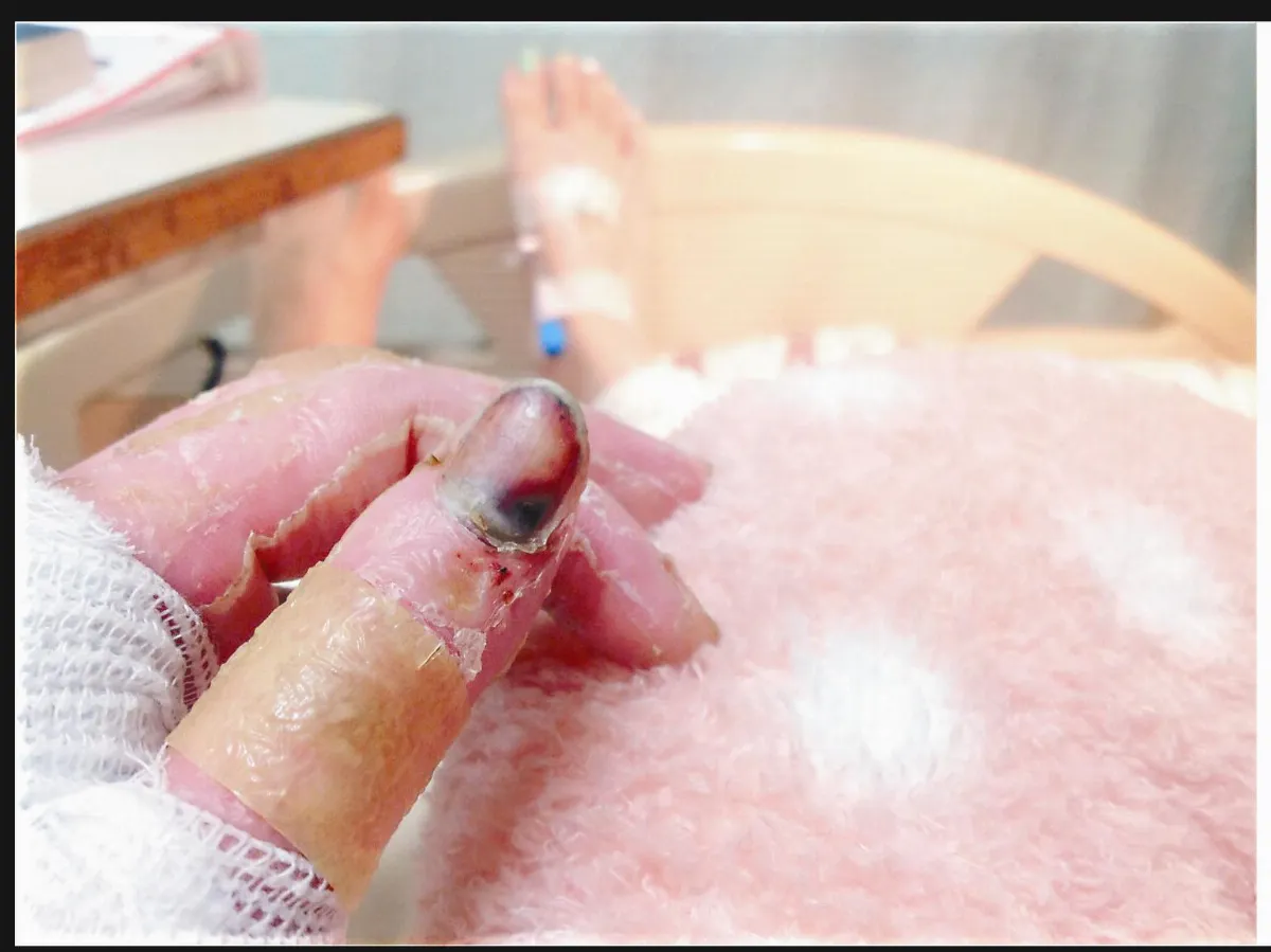 傷疤女警 氣爆重生