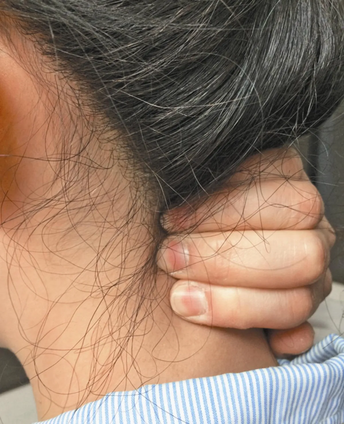 硬頸族  別扭脖子 3招疲勞OUT