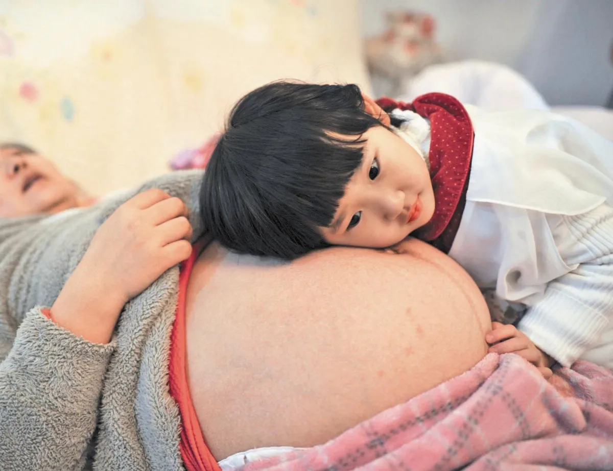 懷孕 4 個月 調過敏體質關鍵