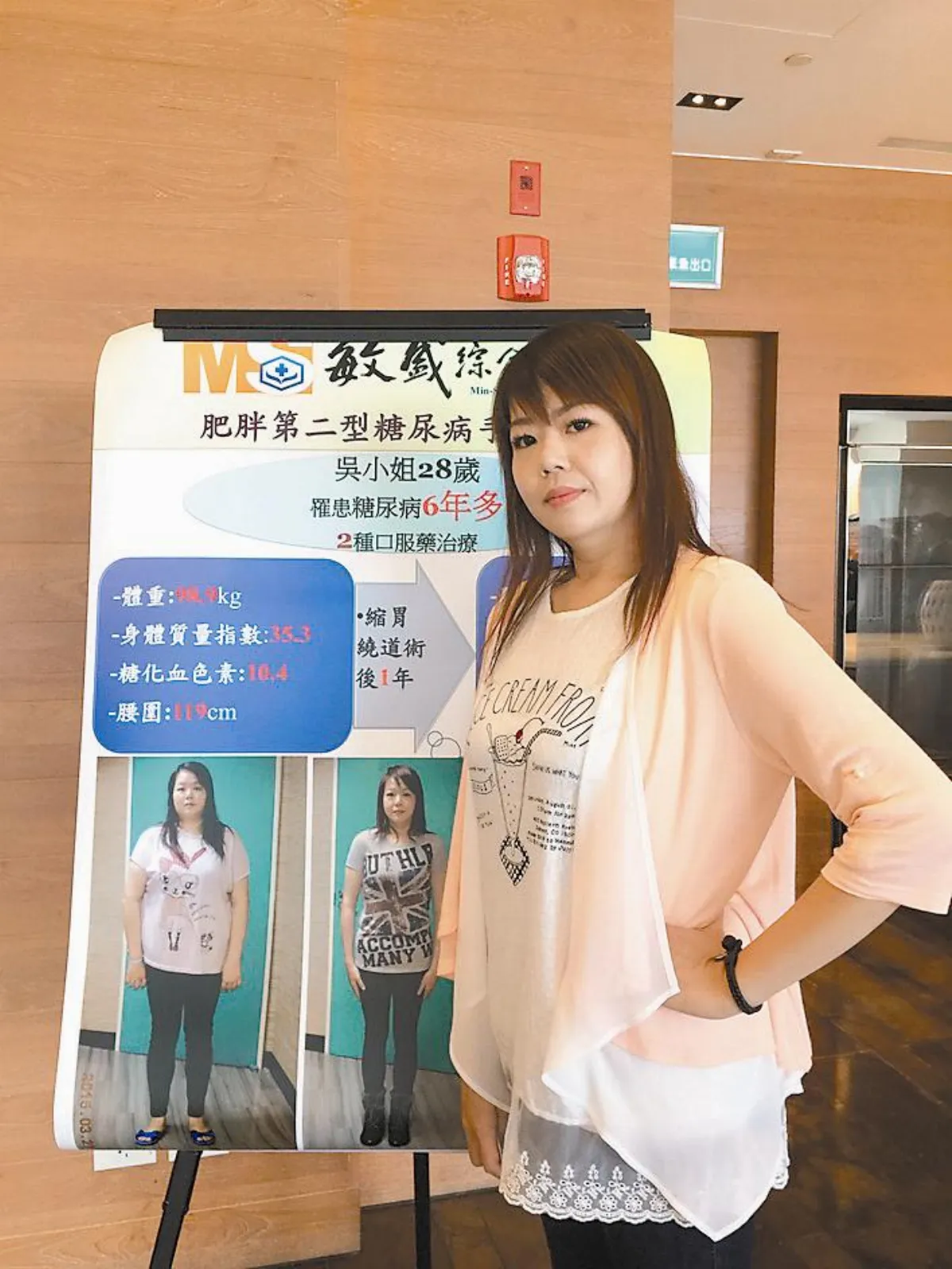 糖尿病治療新指引 糖友手術減重 有效控血糖