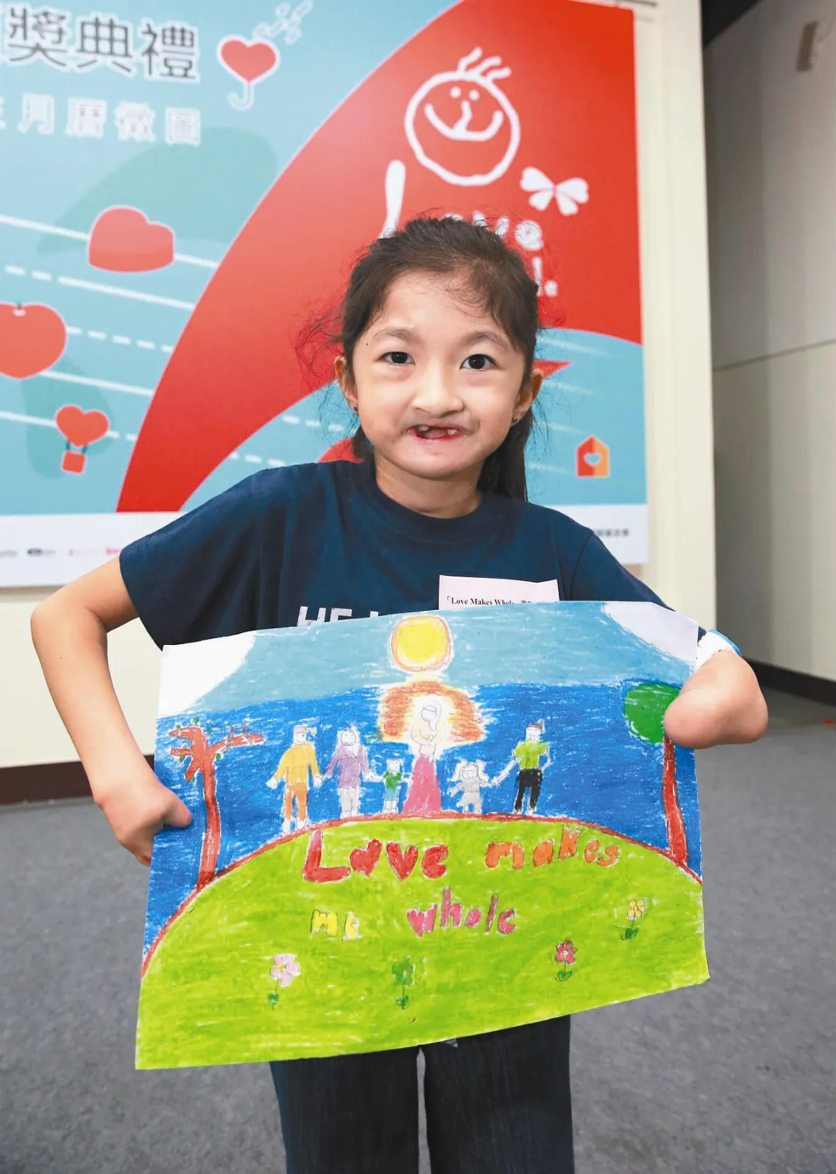 這張臉曾經破碎 愛讓她完整