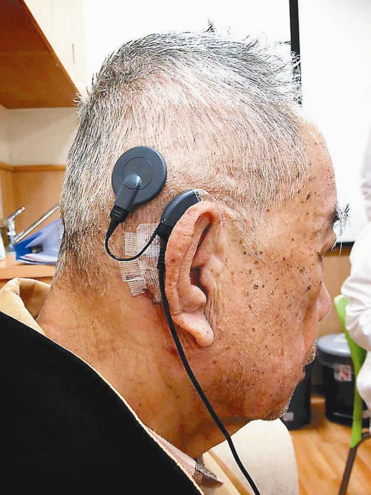 失聰成阿宅 裝電子耳恢復活力