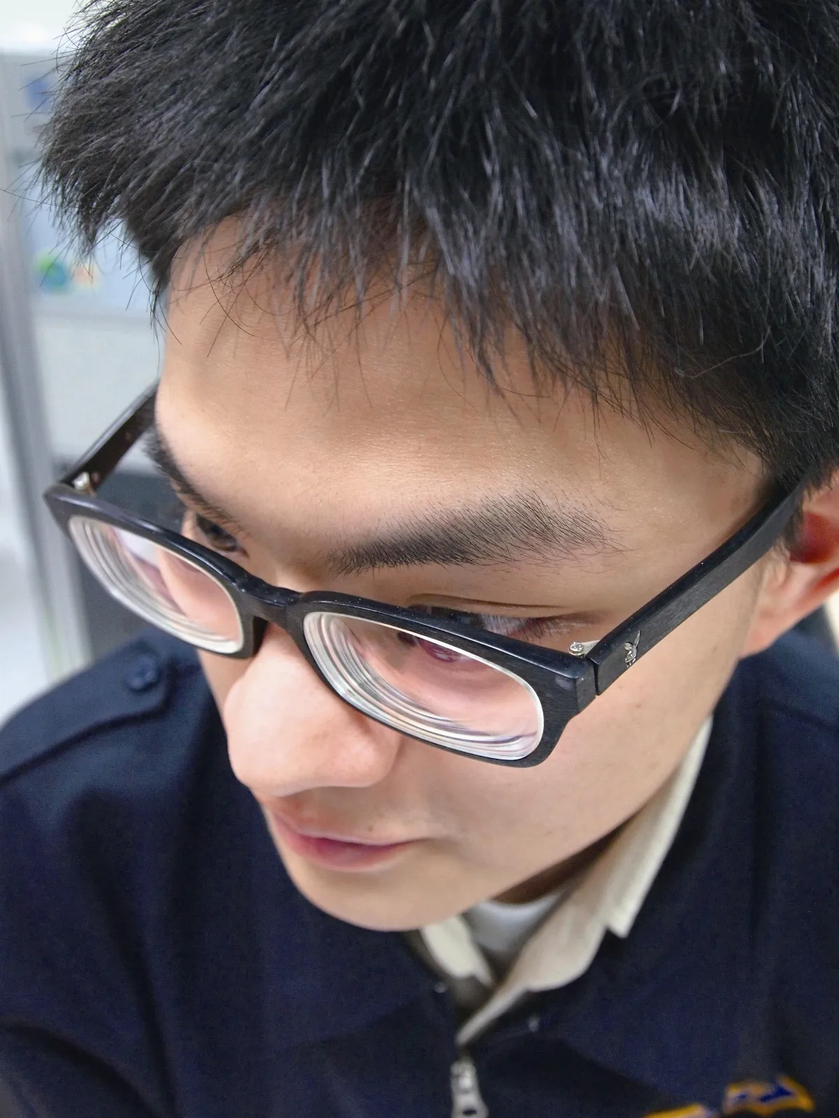 護眼專欄  高度近視 當心眼睛老得快
