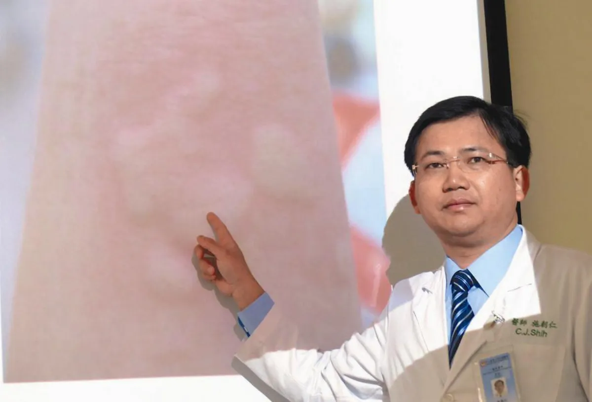 起膨疹失眠 慢性蕁麻疹作祟