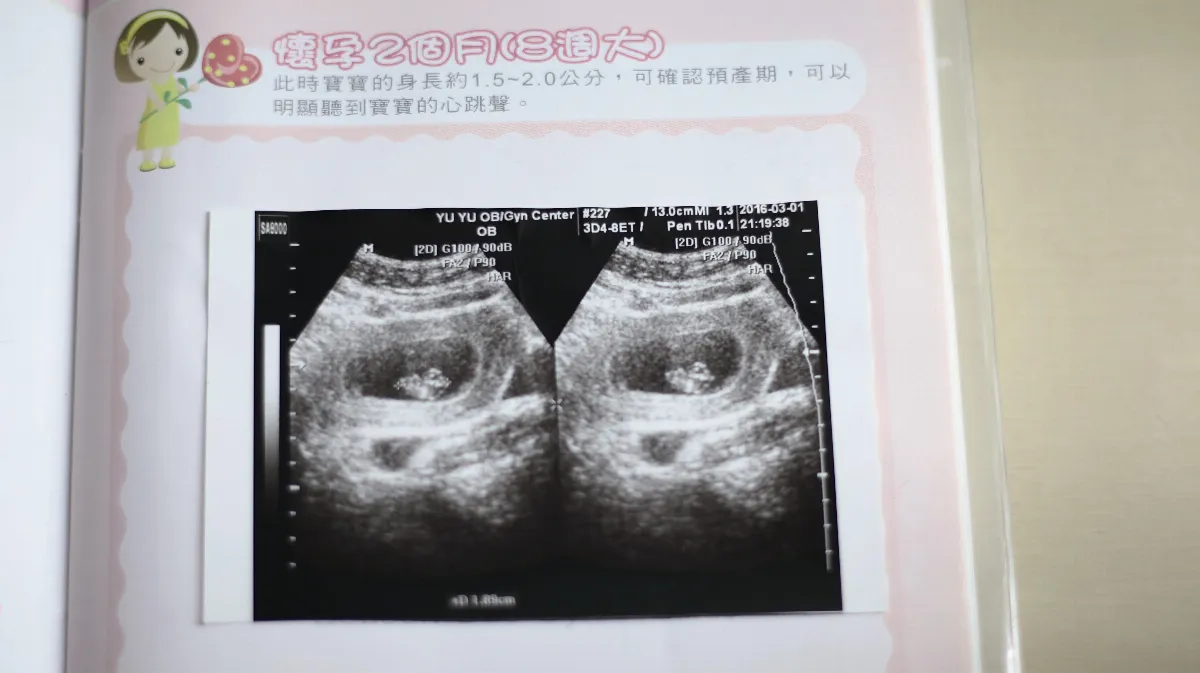 新登場 荳伴 小日子 荳荳的心跳