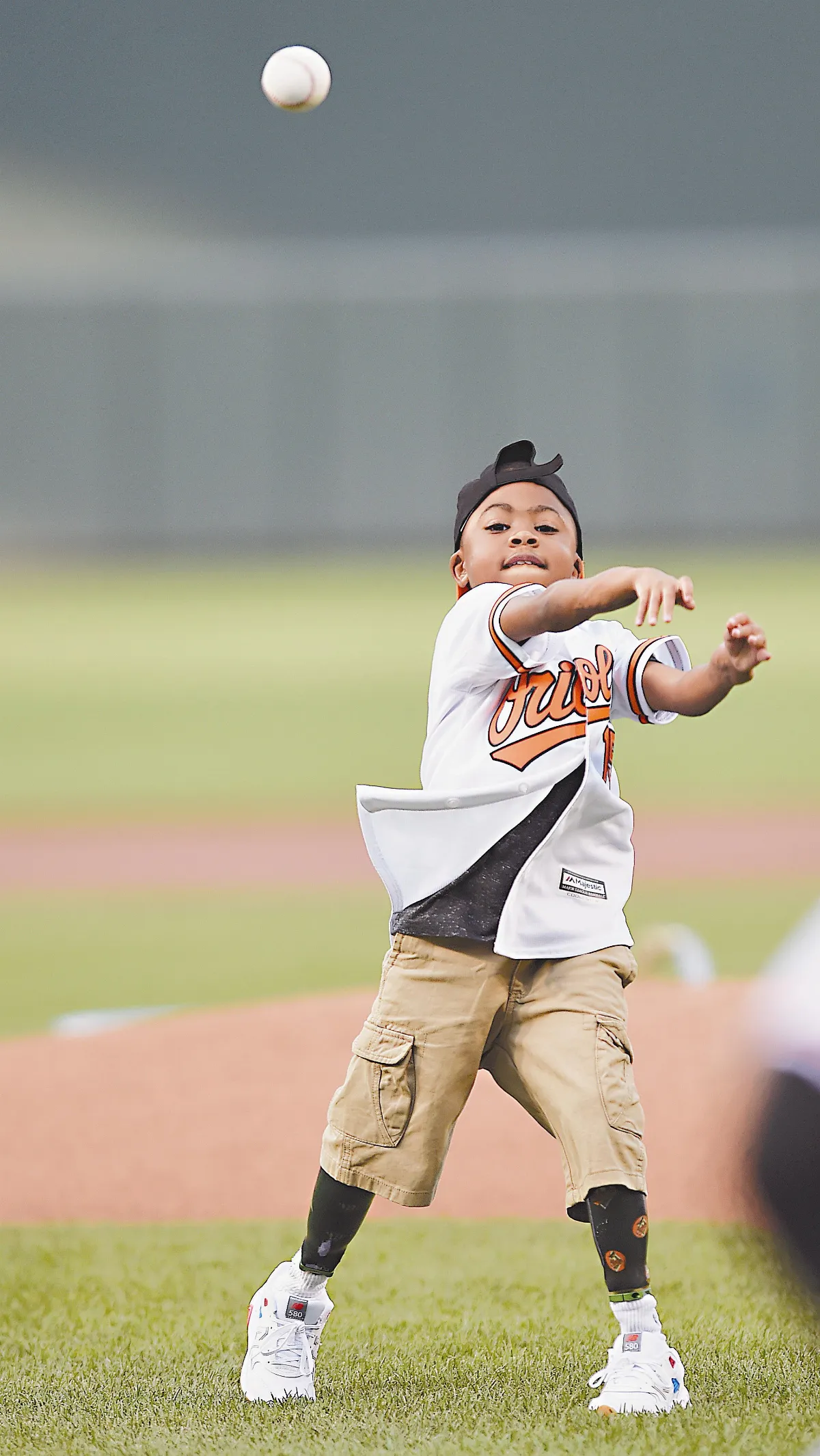 首位雙手移植男童 揮棒打球