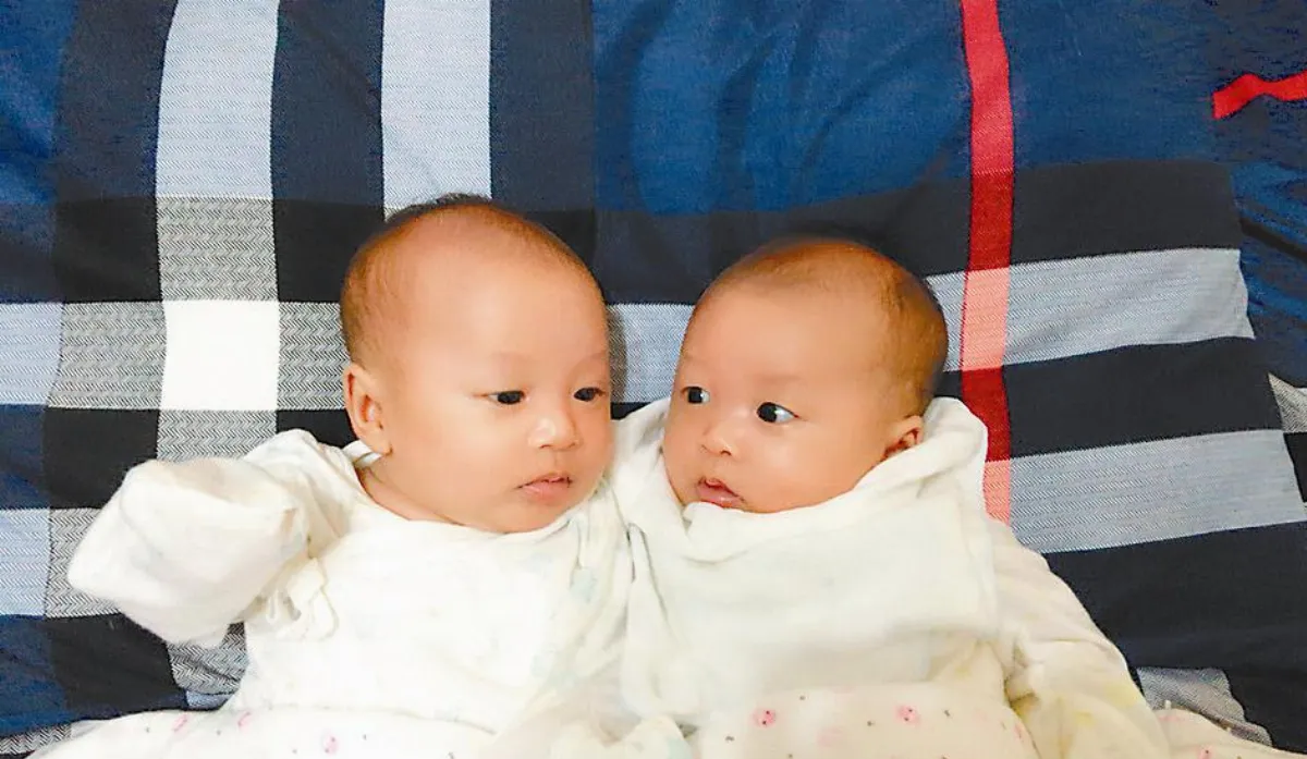 雙胞胎間輸血症候群 胎兒鏡手術挽救