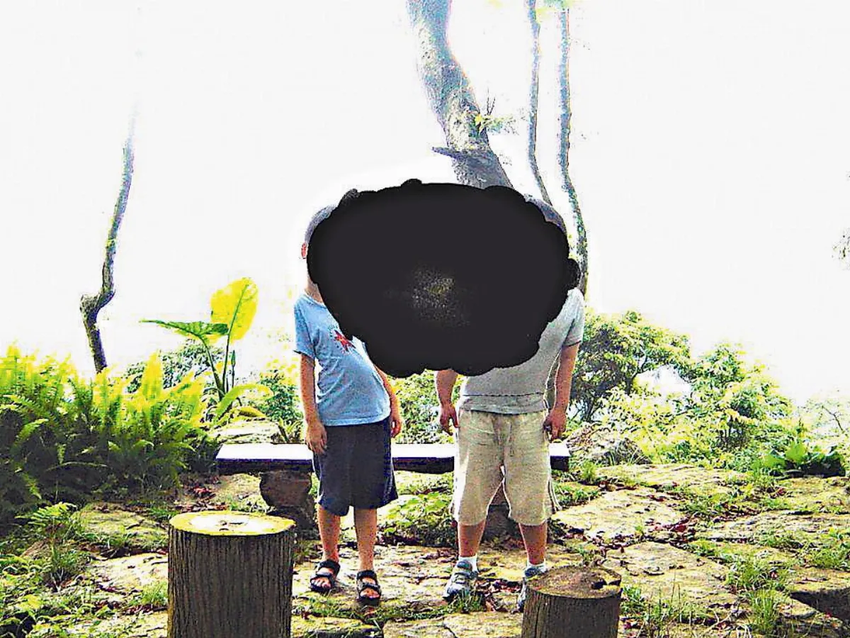 養眼專欄 黃斑部病變開刀能解決嗎？