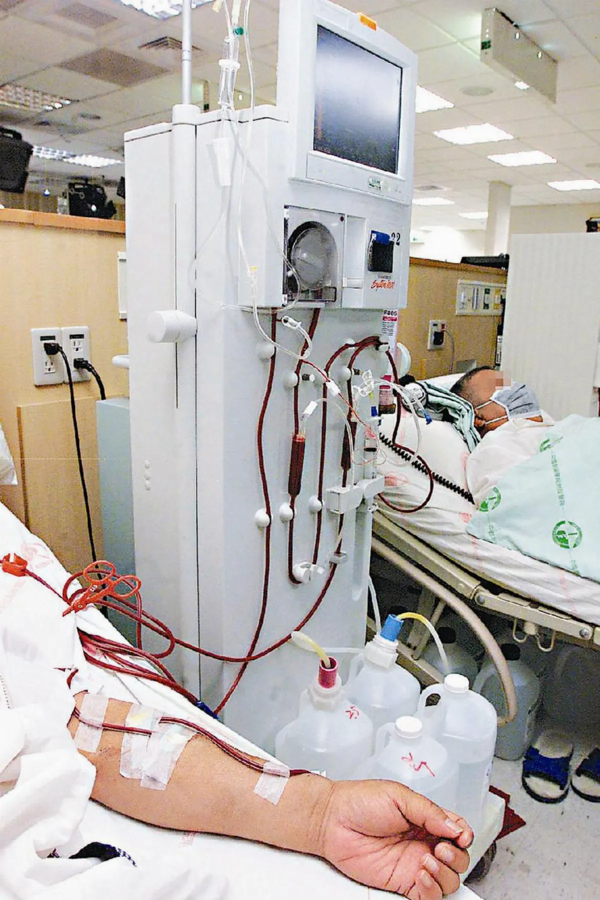 健保10大病 思覺失調症進榜