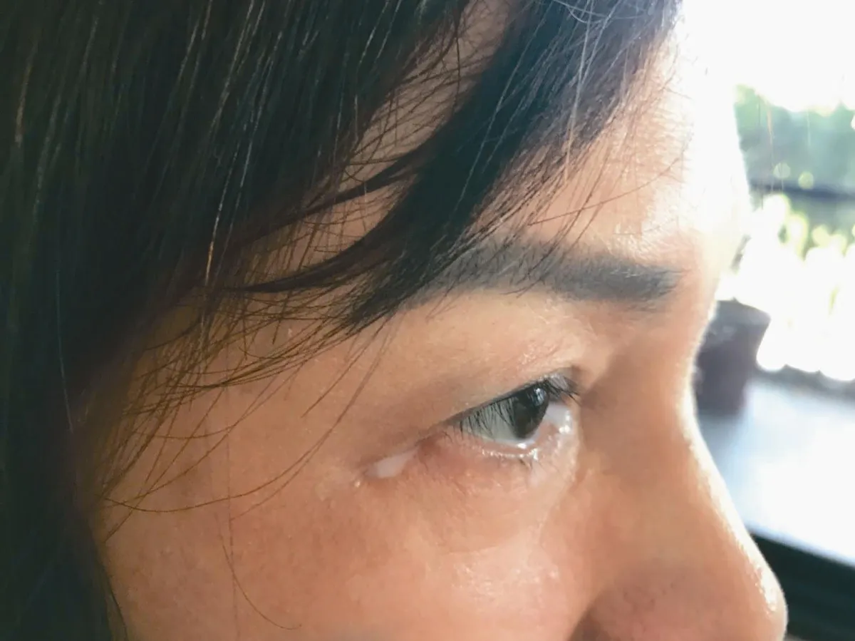 養 眼 專欄 眼睛永遠溼答答是好是壞？