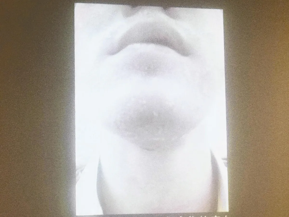 抑制發炎因子 緩解皮膚搔癢