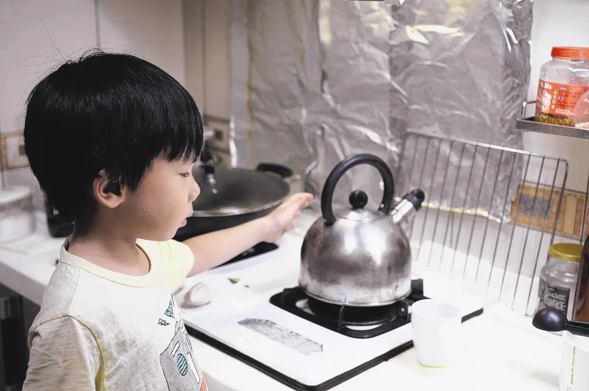 幼兒燙傷水泡比10元硬幣大 應就醫
