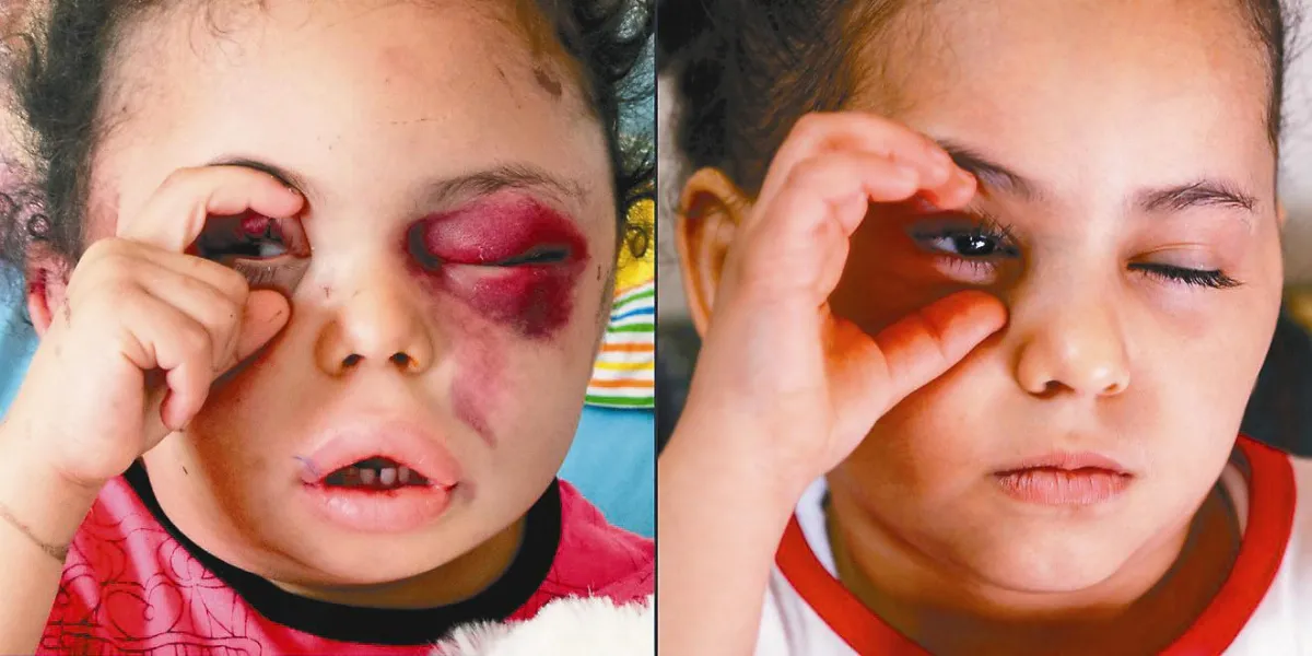 葉門小女孩 揮別惡運