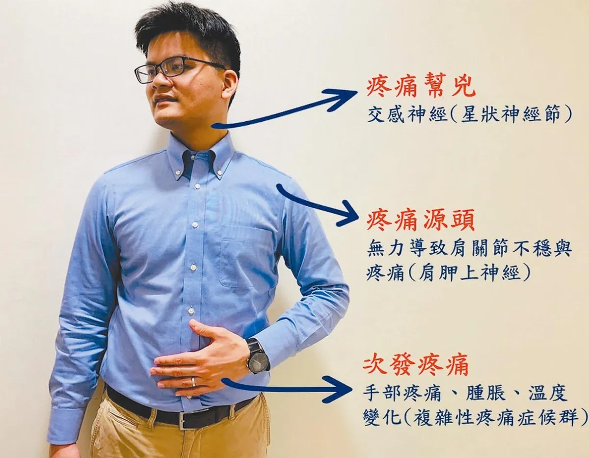 中風漢真肩苦 介入性疼痛治療助復健