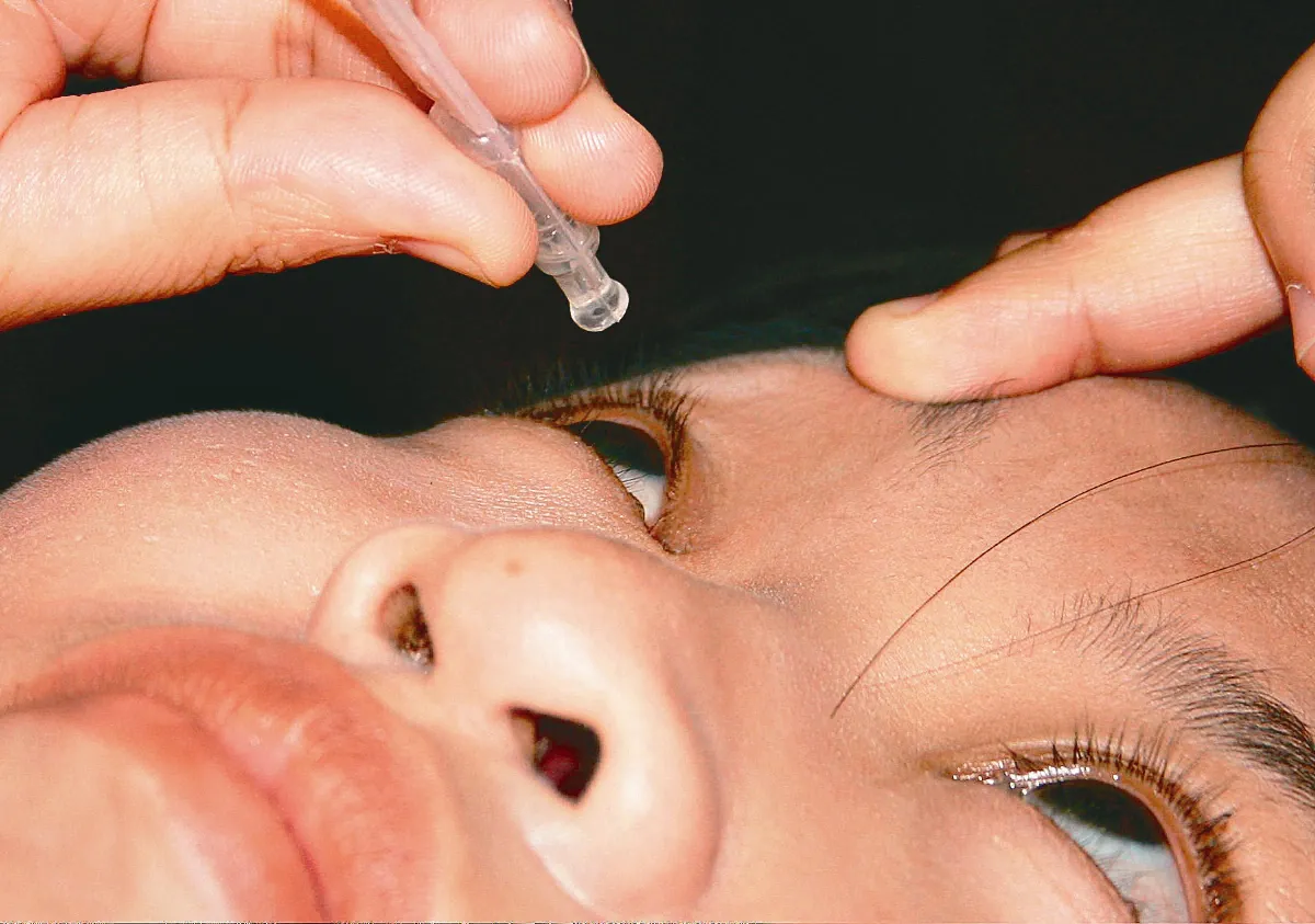 養 眼 專欄 只有乾眼症的人才點人工淚液嗎？