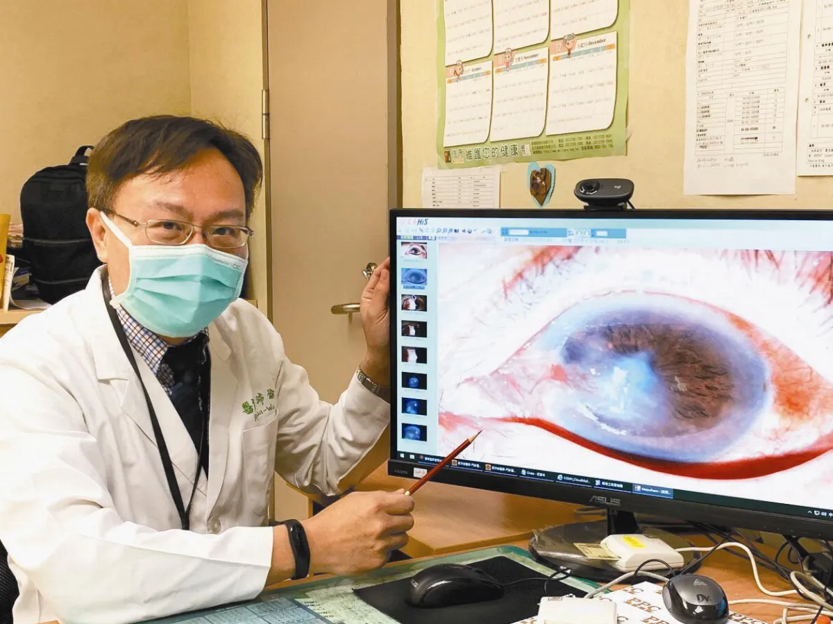 防疫壓力大 眼染帶狀泡疹