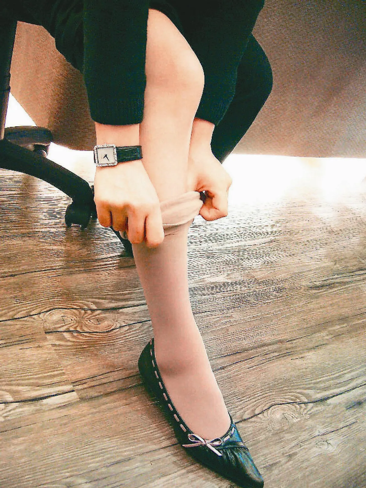 靜脈曲張 輕忽不得