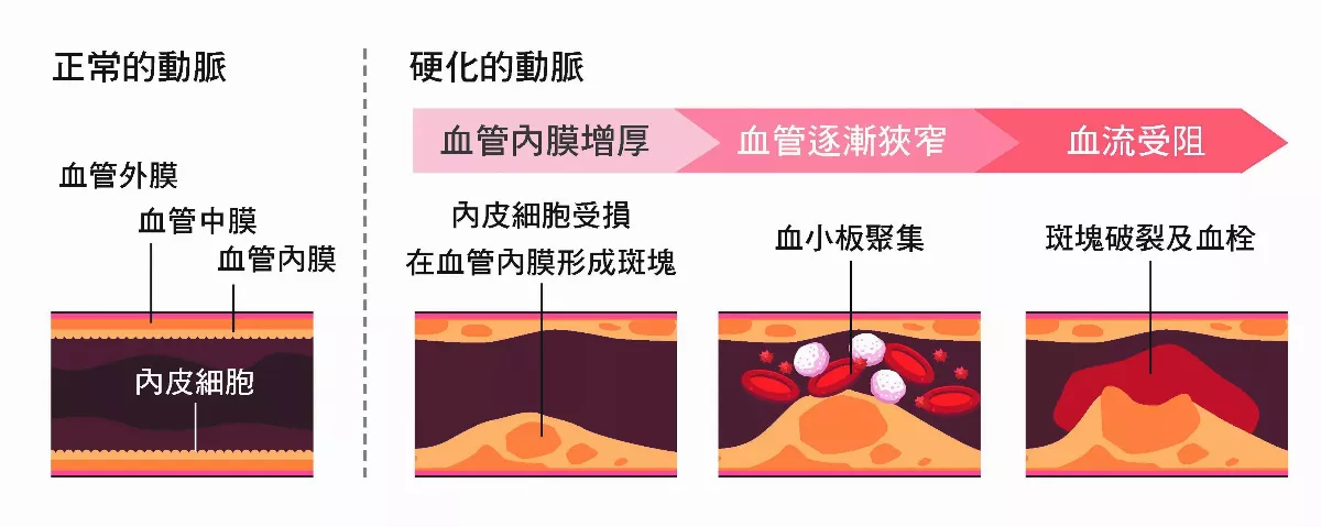 俠醫楊智鈞 守護您心臟的健康