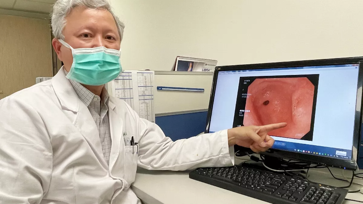護理師上腹悶痛 竟罹最凶險胃癌 幸好早發現
