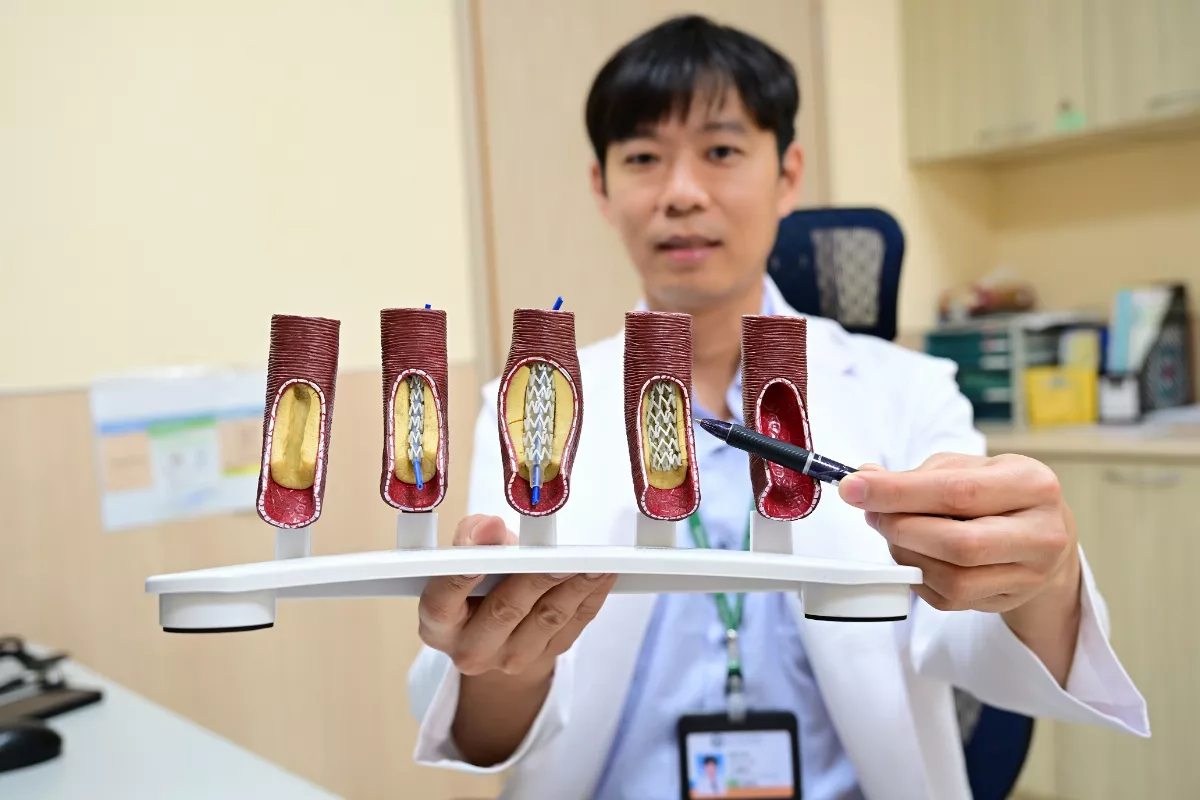 8旬婦反覆胸痛 靠「它」揪右冠狀動脈全塞