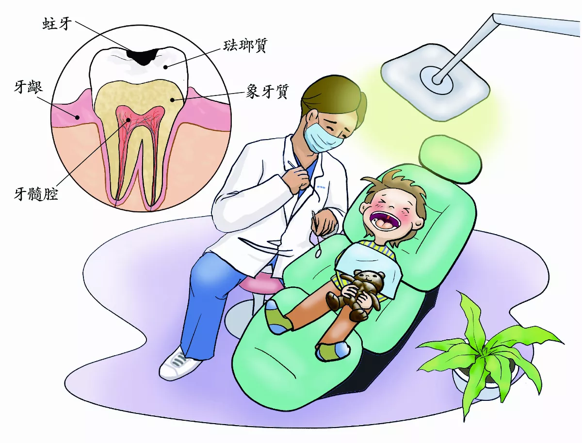 補牙挽救蛀牙