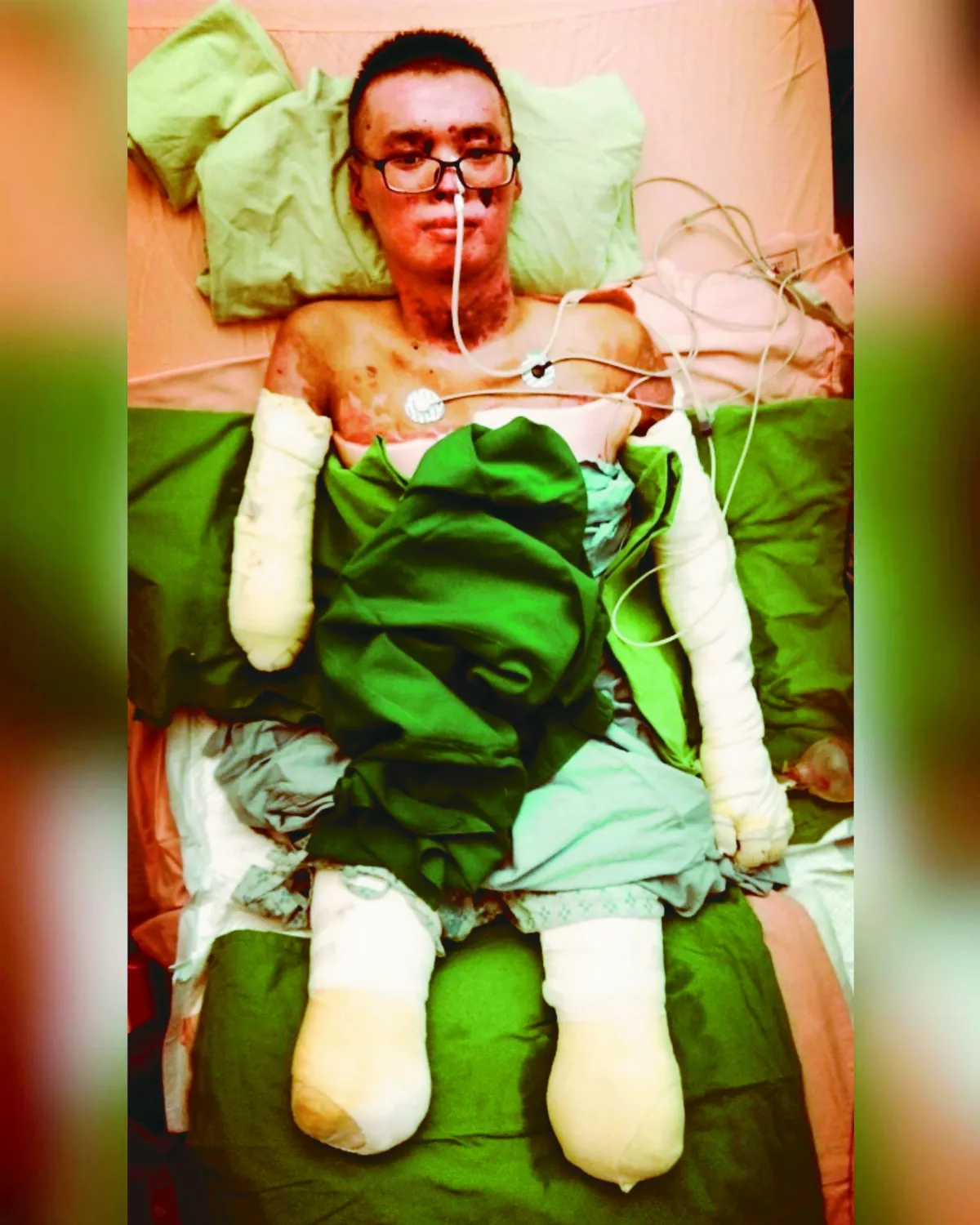 黃博煒 截後人生重新找回幸福