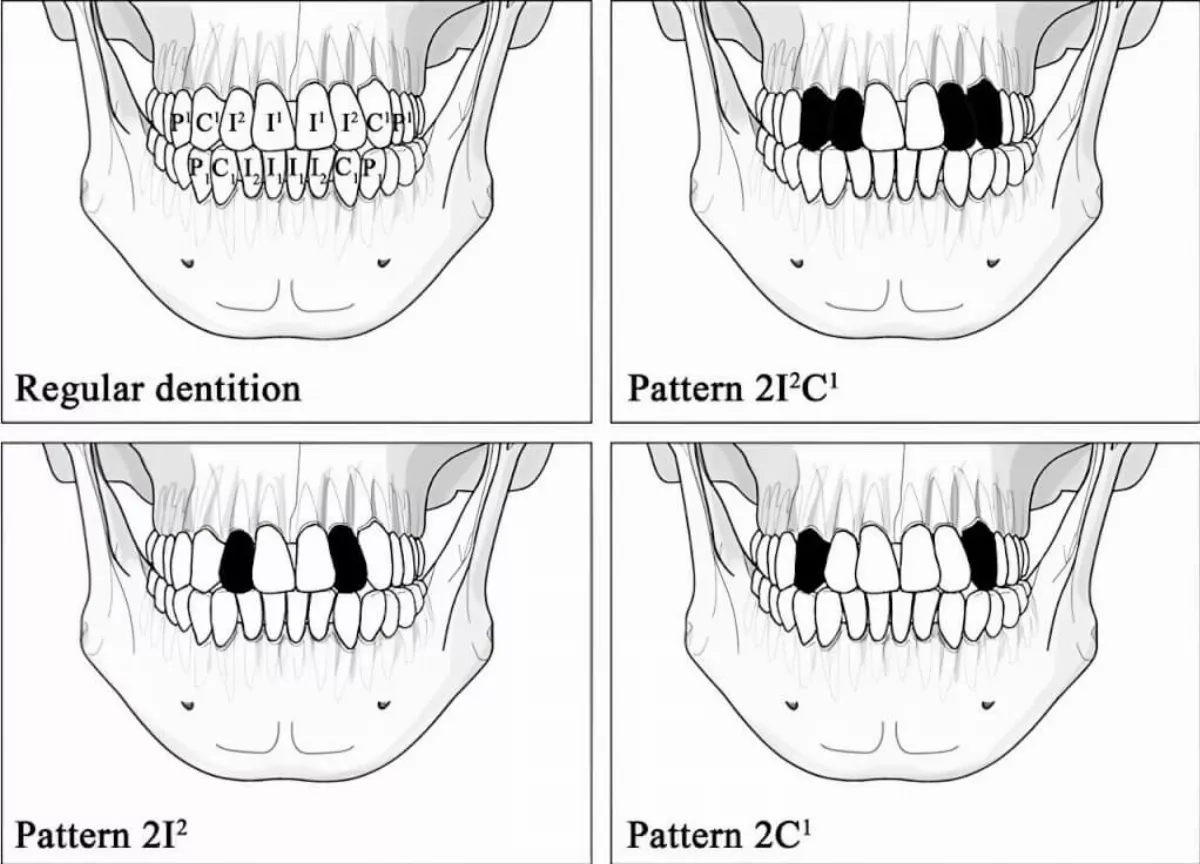 台灣新石器時代流行這件事 彰顯美感和地位