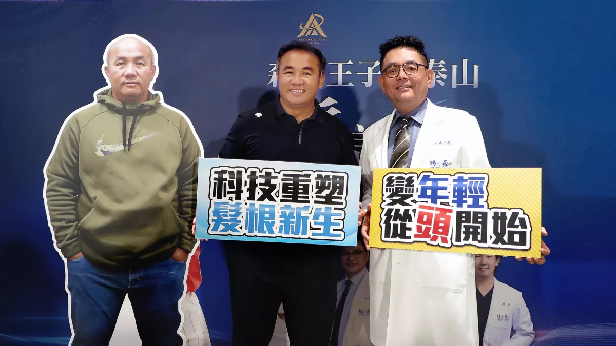 雄性禿患者新福音 張泰山：我的頭髮回來了