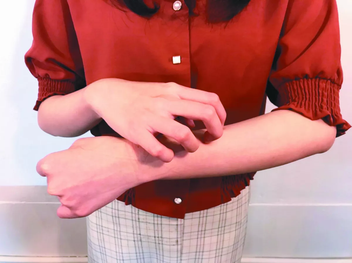 皮膚保溼 防異位性皮膚炎發作